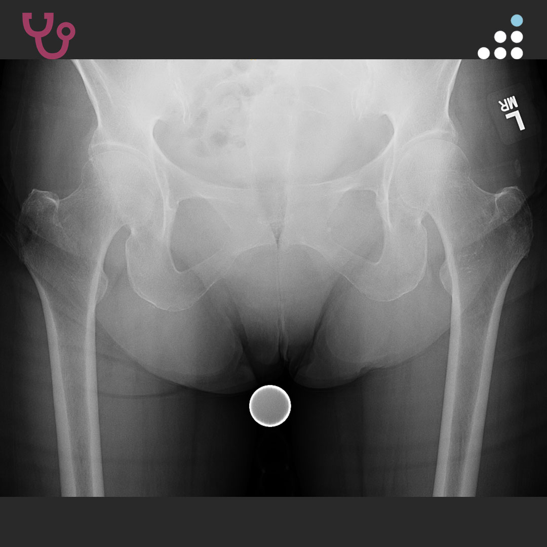 Orthobullets tweet media