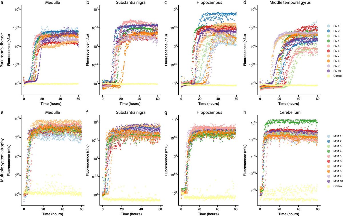 The Science of Parkinson's (@scienceofpd) on Twitter photo Man, <a href="/JamesAWiseman/">James Wiseman</a> is a beast!
Two papers in 1 week!
In a new paper with <a href="/VDieriks/">Victor Dieriks</a> & colleagues, he presents a refinement of the RT-QuIC protocol & analysis pipeline that can distinguish between #Parkinsons & #MSA, plus between MSA phenotypes
…alneurodegeneration.biomedcentral.com/articles/10.11… Man, <a href="/JamesAWiseman/">James Wiseman</a> is a beast!
Two papers in 1 week!
In a new paper with <a href="/VDieriks/">Victor Dieriks</a> & colleagues, he presents a refinement of the RT-QuIC protocol & analysis pipeline that can distinguish between #Parkinsons & #MSA, plus between MSA phenotypes
…alneurodegeneration.biomedcentral.com/articles/10.11…