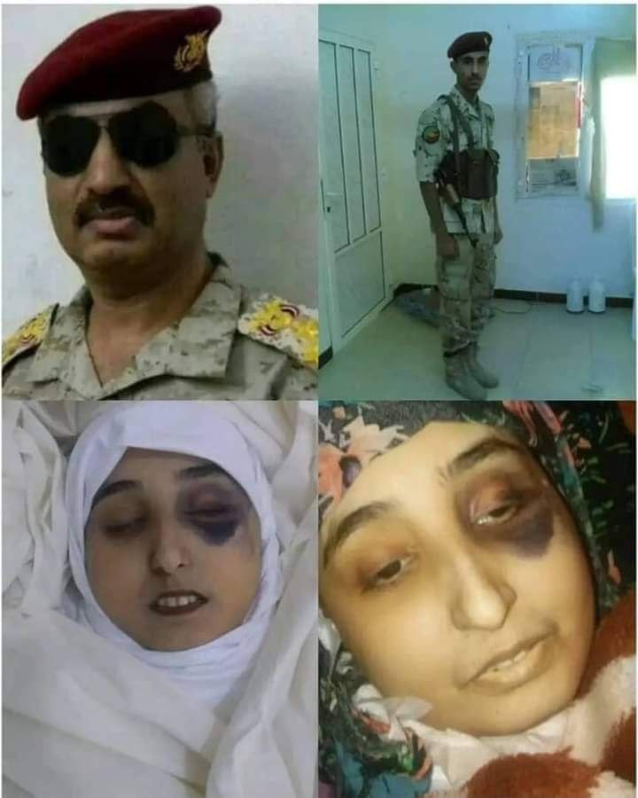 لن أنسى ما حييت حين غضب السيد القائد في الحرب الرابعة بخصوص موضوع الأسرى 
وقال :
   ( قلنا عاملوهم كضيوف كضيوف بتفهموا ) . 

إن ما يحدث في سجون الوكلاء  سواء في مأرب أو تعز أو عدن  يزكم الأنوف ويندى له الجبين  

أين هم  من أخلاق القرآن وتعاليم الإسلام 
#سجون_مرتزقة_الصهاينة