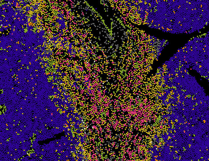 Science Immunology (@sciimmunology) on Twitter photo Scientists have identified bone marrow #BreakoutLesions as hotspots for tumor-immune cell interactions, which could contribute to disease progression in patients with #MultipleMyeloma. <a href="/haas_lab/">Haas Lab</a> <a href="/HDMyeloma/">Heidelberg Myeloma</a> <a href="/hi_stem_lab/">HI-STEM - Cancer and Stem Cells in Heidelberg</a>
Read more in Science #Immunology: scim.ag/4hMrLHs Scientists have identified bone marrow #BreakoutLesions as hotspots for tumor-immune cell interactions, which could contribute to disease progression in patients with #MultipleMyeloma. <a href="/haas_lab/">Haas Lab</a> <a href="/HDMyeloma/">Heidelberg Myeloma</a> <a href="/hi_stem_lab/">HI-STEM - Cancer and Stem Cells in Heidelberg</a>
Read more in Science #Immunology: scim.ag/4hMrLHs