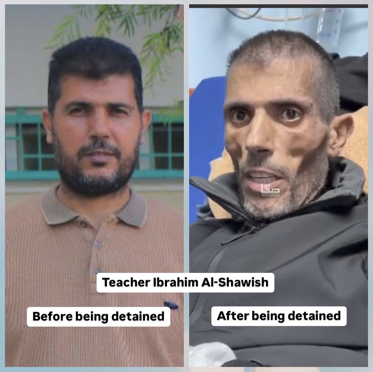 This is my teacher, Ibrahim Al-Shawish, from my hometown, and one of my high school teachers. He was arrested by the Zionist occupation during the genocide and was released today. Take a look at his face after the ordeal!

I speak for both myself and him when I say: Fuck you, you