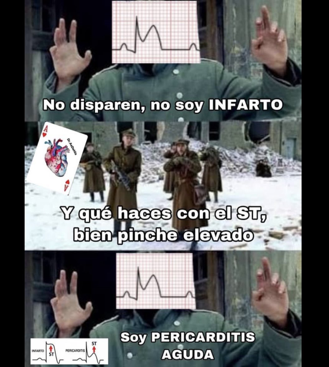 DAsdehis's tweet photo. No toda elevación del ST es isquemia, si es lo primero que hay que descartar, pero también hay que fijarse en la forma...😂🫀⚡️ https://t.co/xbIxY6E314