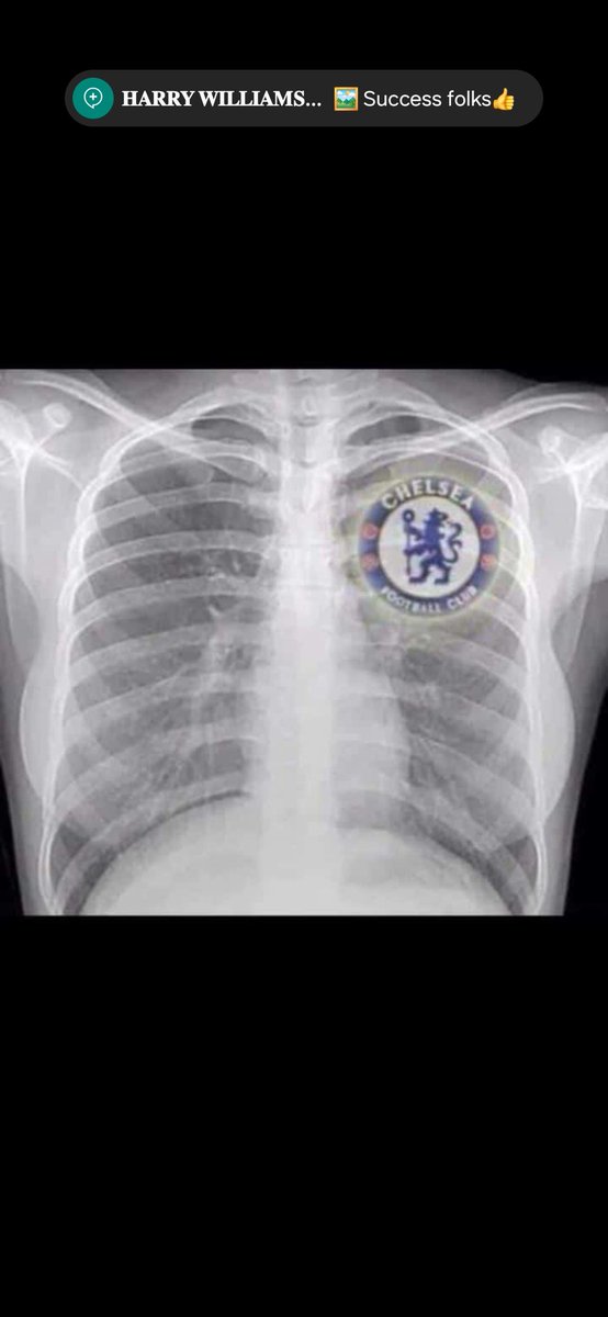 mchuma10's tweet photo. @ChelseaFC Maresca is turning Chelsea to a mid club again https://t.co/YjThbHP2Bw