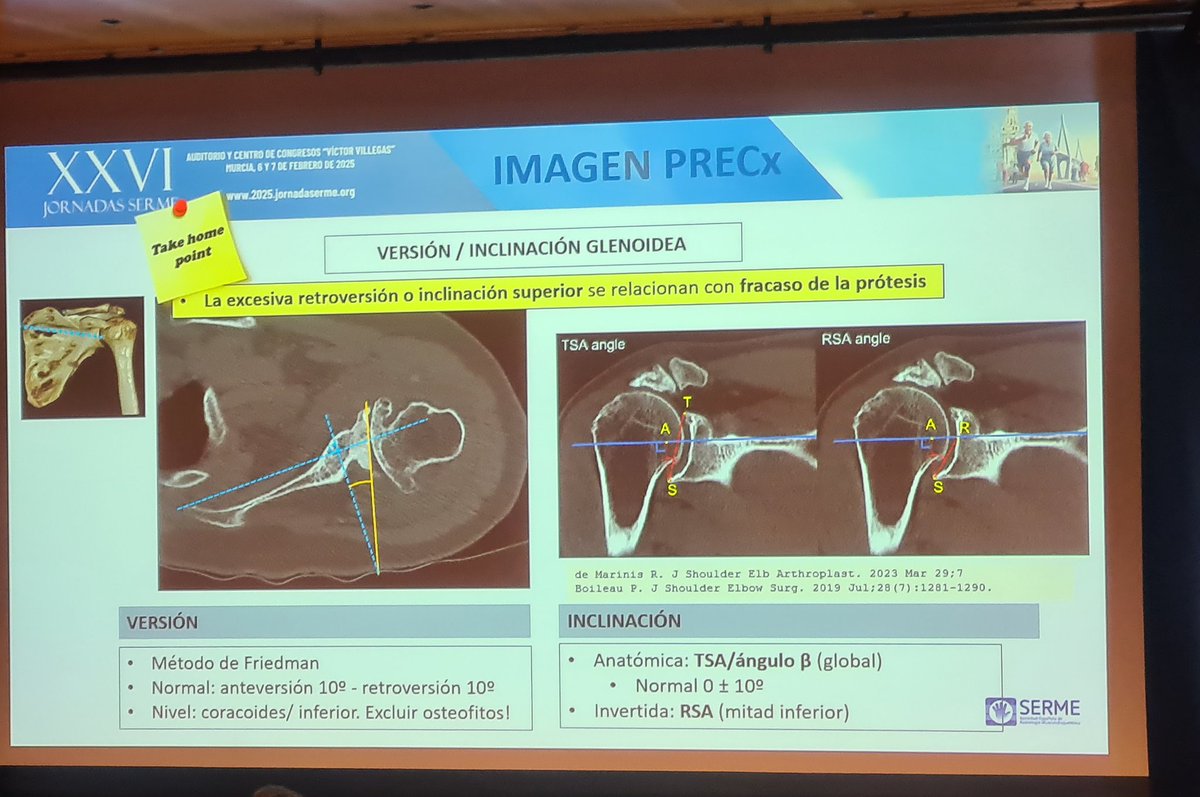 IreneGamar's tweet photo. De vuelta de unas magníficas Jornadas sobre "Actualización de enfermedad degenerativa osteomuscular" por parte de @MskSerme, donde hemos podido profundizar en temas muy interesantes y frecuentes en el día a día hospitalario. 

#JornadasSERME #MskRad https://t.co/aXQCOgE0hN