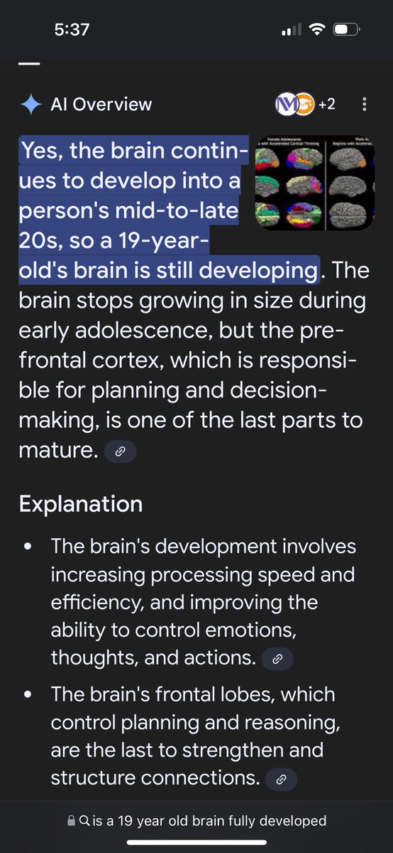 19-year-old brains