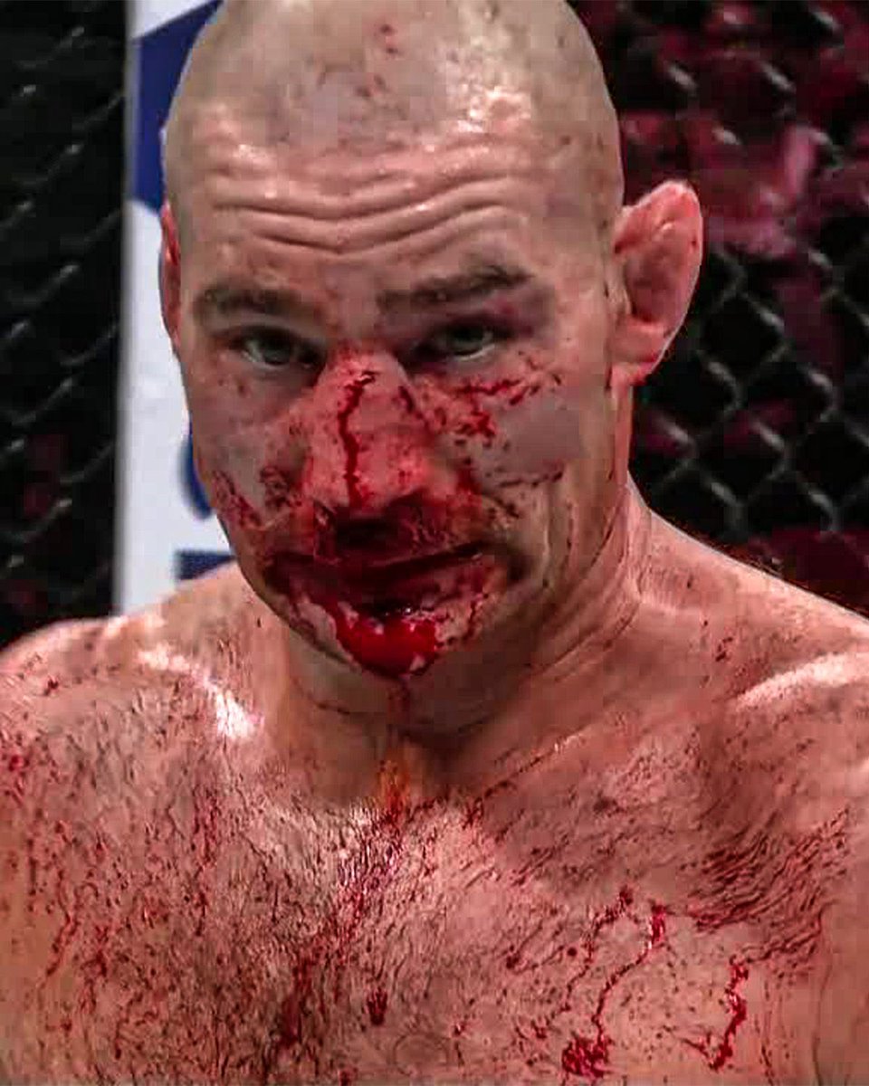 lamFarhan's tweet photo. @danawhite Du Plessis changed Strickland’s face forever! #AndStill #UFC312 https://t.co/vaugbNk3qQ