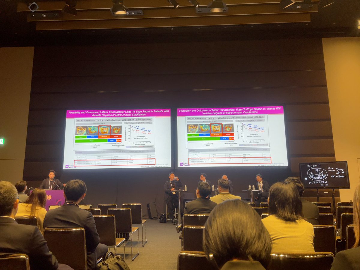 Misako TOKI (@misako_desu) on Twitter photo This is the last session of the day3.
Nightmare in mitral valve intervention.🖇️
📍Room London
#PCRTokyo <a href="/PCRonline/">PCRonline 🫀</a> <a href="/Miho_Fukui_/">Miho.Fukui</a> <a href="/misako_desu/">Misako TOKI</a> <a href="/TomokiOchiai/">Tomoki Ochiai</a> <a href="/drtsakamoto/">Tomohiro SAKAMOTO, MD, PhD</a> <a href="/Ravinay/">Ravinay Bhindi</a> <a href="/OhnoTuri/">Yohei Turi Ohno</a> This is the last session of the day3.
Nightmare in mitral valve intervention.🖇️
📍Room London
#PCRTokyo <a href="/PCRonline/">PCRonline 🫀</a> <a href="/Miho_Fukui_/">Miho.Fukui</a> <a href="/misako_desu/">Misako TOKI</a> <a href="/TomokiOchiai/">Tomoki Ochiai</a> <a href="/drtsakamoto/">Tomohiro SAKAMOTO, MD, PhD</a> <a href="/Ravinay/">Ravinay Bhindi</a> <a href="/OhnoTuri/">Yohei Turi Ohno</a>