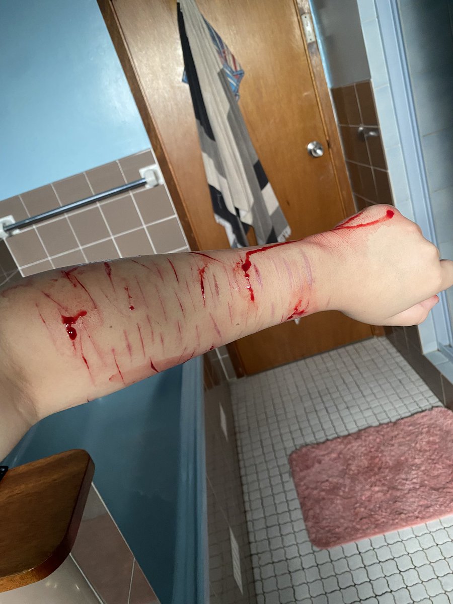 MizukisBloody's tweet photo. Did a bath session where I hit deep styro and beans #slittwt #shedtwt #shtwt #selfharm https://t.co/qmVNeyoTGl