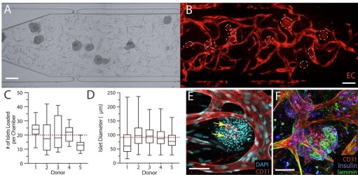 Would you like to know how to establish the islet-VMO as a novel, ex vivo platform for studying human islet biology in both health and disease? Find out here: ow.ly/zxic50UPhrx #Biofabrication