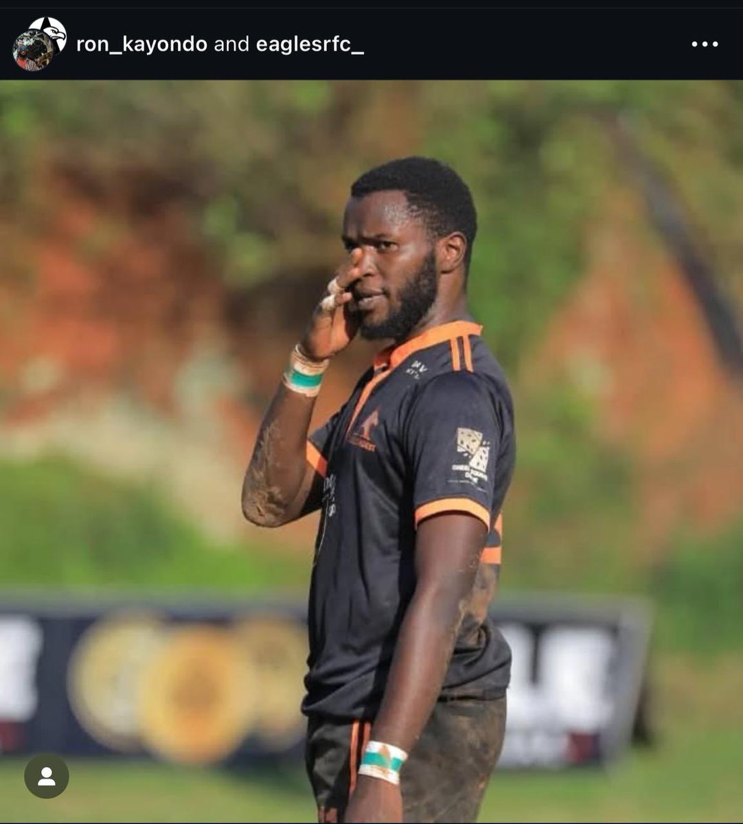 Very bad news. Kayondo Ronnie an eagles play who sustained an injury yesterday in kyadodo and later operated at Kampala hospital has passed on today at Kampala Hospital

May his soul rest in peace 😢(from WhatsApp)

Ronnie was a macosian and a Griffins rugby player RIP bro ❤️