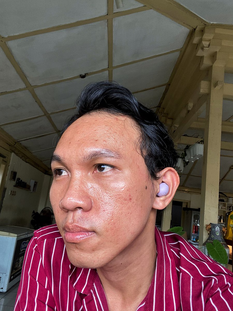 skinchemically's tweet photo. Before-after setelah rajin pakai serum acne Fuscia selama 2 minggu aja. https://t.co/sqwPgf6WFL