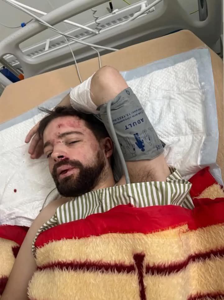 TelekanalNTA's tweet photo. 🤯Викрали та незаконно мобілізували: викладача ЛНУ знайшли під Києвом у критичному стані  

Степана Більченка забрали у відділення ТЦК, коли він йшов на роботу. Про це розповів у фейсбуці його друг Владислав Кононов

Чекаємо на офіційні коментарі... https://t.co/ltmJ4D4wN7