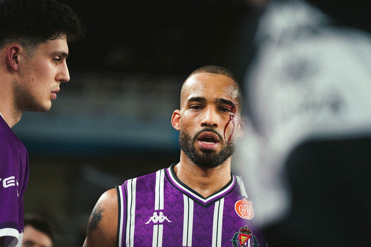 🤨 Dos puntos de sutura... y falta personal del que sangra.

<a href="/UEMC/">UEMC</a> #PucelaBasket