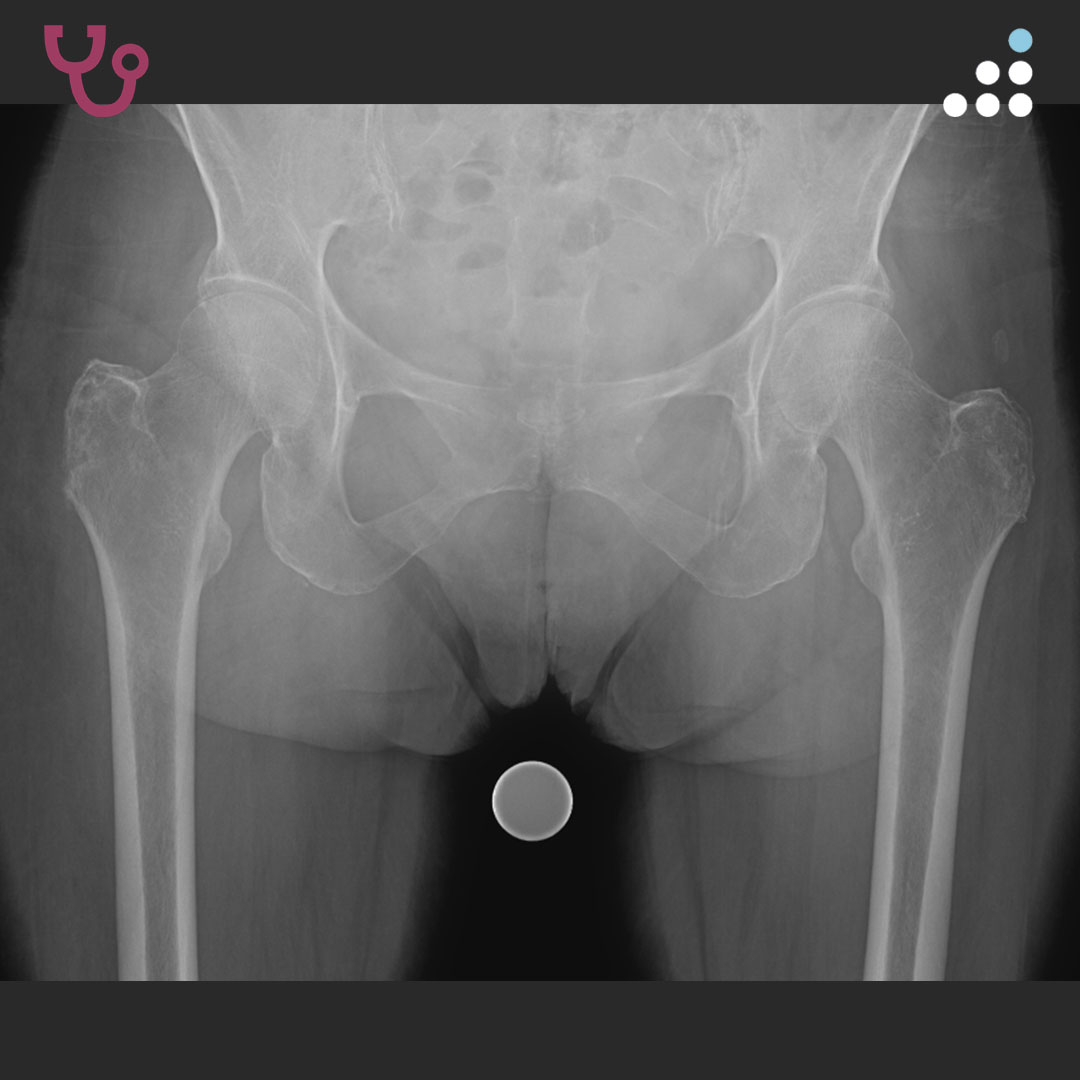 Orthobullets tweet media