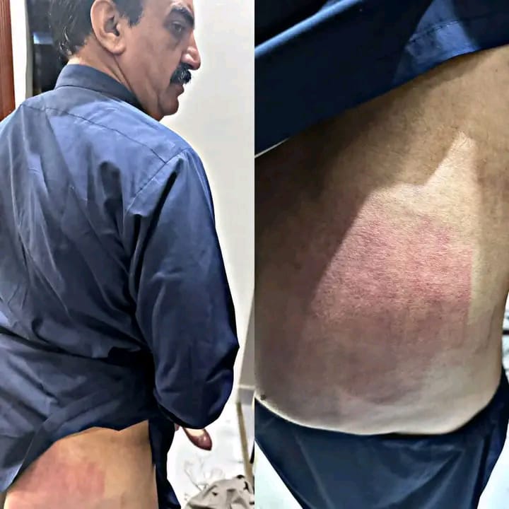 MohUmair87's tweet photo. ڈیرہ غازی خان این اے 184 سے تحریک انصاف کے رہنما اور فارم 45 کے ایم این اے علی محمد کھلول کو ریلی نکالنے پر کو پولیس نے گرفتار کیا جہاں انکو نامعلوم افراد نے وحشیانہ تشدد کا نشانہ بنایا۔ https://t.co/Q6RFzykJr8