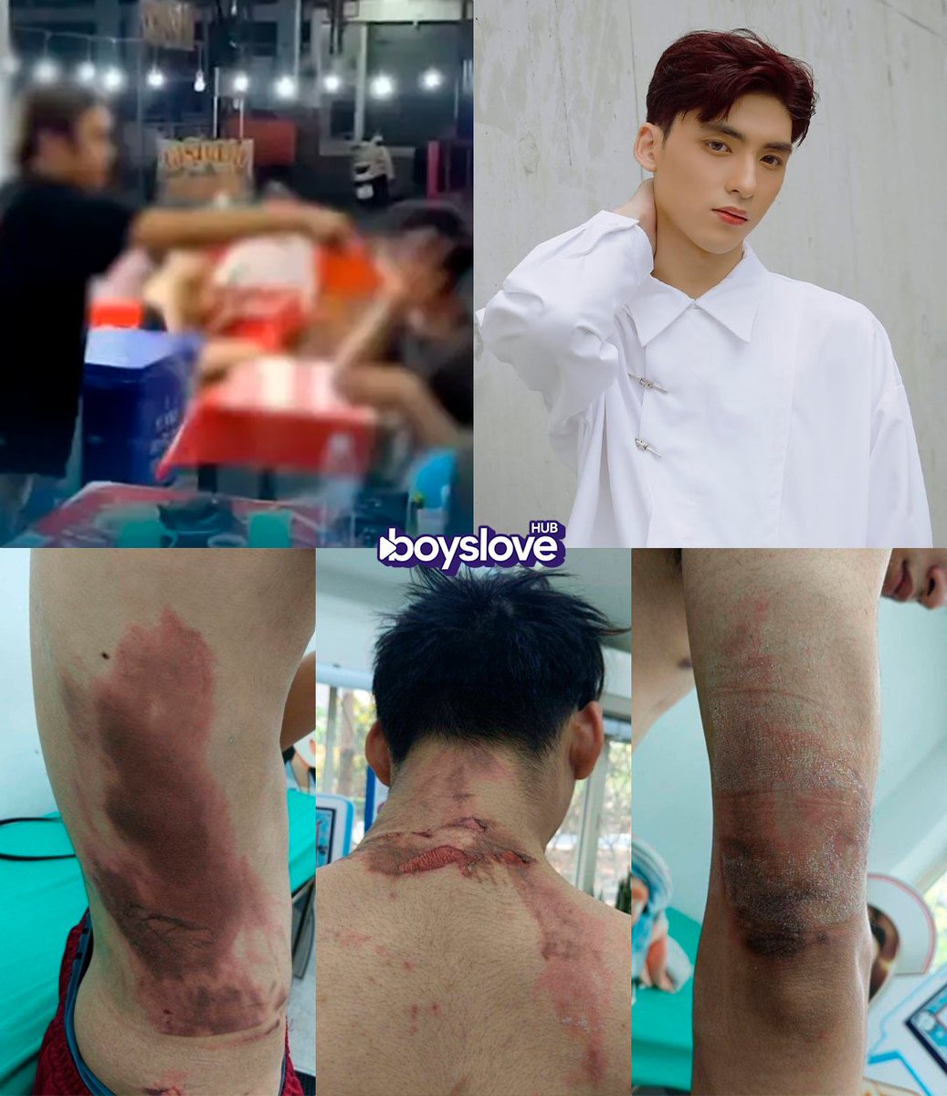 hubboyslove's tweet image. Centenas de LGBTQ+ cercam condomínio na Tailândia em busca de vingança contra agressora que despejou sopa fervente em jovem gay. #สาดน้ําร้อน #รังสิต

A vítima, que é Mister Teen Global Tailândia, denunciou o caso e está ganhando as redes. Entenda tudo nesta thread 🧵