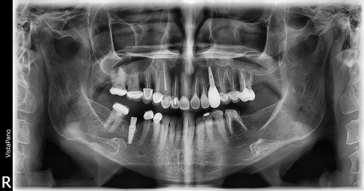 AtziRain's tweet photo. @LhKeyla Teeth mutilation #hateCrime Dra Rossana Gomez Trevia Organized Crime #PanamaPapers #PandoraPapers prosecution is needed Tren de Aragua, Clan del Golfo, Dental Clinics in #Panama https://t.co/Ldaxc48Ryx