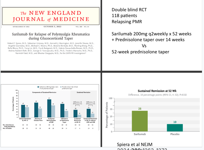Eric Dein (@ericdeinmd) on Twitter photo <a href="/RichardPAConway/">Richard Conway</a> #RNL2025 <a href="/RheumNow/">Dr. John Cush</a>
RCT for PMR - MTX does not help
SAPHYR trial - NEJM - Sarilumab showed sustained remission at W52 for relapse (28 v 10%)
PMR-SPARE- TCZ for new-onset
Single dose of RTX? Not as impressive as IL-6 data
JAKi? BACHELOR- Bari, EAST PMR - Tofa <a href="/RichardPAConway/">Richard Conway</a> #RNL2025 <a href="/RheumNow/">Dr. John Cush</a>
RCT for PMR - MTX does not help
SAPHYR trial - NEJM - Sarilumab showed sustained remission at W52 for relapse (28 v 10%)
PMR-SPARE- TCZ for new-onset
Single dose of RTX? Not as impressive as IL-6 data
JAKi? BACHELOR- Bari, EAST PMR - Tofa