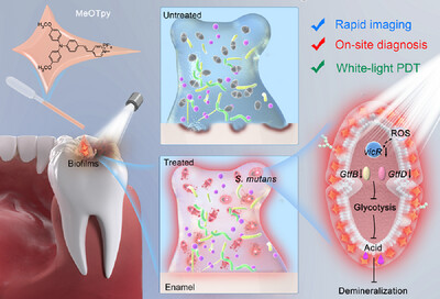 Aggregate (@aggregateoa) on Twitter photo Early View💡
"Molecular #Diagnosis and Therapy of Dental Caries by #Oral #Microbiome-Selective Aggregation-Induced Photosensitivity" by Xuedong Zhou, Ben Zhong Tang, Shaohua Ge & Jianhua Li et al. <a href="/Jianhua_SDU/">Jianhua Li</a> <a href="/BenZhongTANG1/">Ben Zhong TANG</a> <a href="/cuhksz/">The Chinese University of Hong Kong, Shenzhen</a> <a href="/SCUCN/">Sichuan University</a> <a href="/ShandongU/">山东大学 SHANDONG UNIVERSITY</a> <a href="/WileyBiomedical/">Wiley Biomedical Science</a> #AIE Early View💡
"Molecular #Diagnosis and Therapy of Dental Caries by #Oral #Microbiome-Selective Aggregation-Induced Photosensitivity" by Xuedong Zhou, Ben Zhong Tang, Shaohua Ge & Jianhua Li et al. <a href="/Jianhua_SDU/">Jianhua Li</a> <a href="/BenZhongTANG1/">Ben Zhong TANG</a> <a href="/cuhksz/">The Chinese University of Hong Kong, Shenzhen</a> <a href="/SCUCN/">Sichuan University</a> <a href="/ShandongU/">山东大学 SHANDONG UNIVERSITY</a> <a href="/WileyBiomedical/">Wiley Biomedical Science</a> #AIE