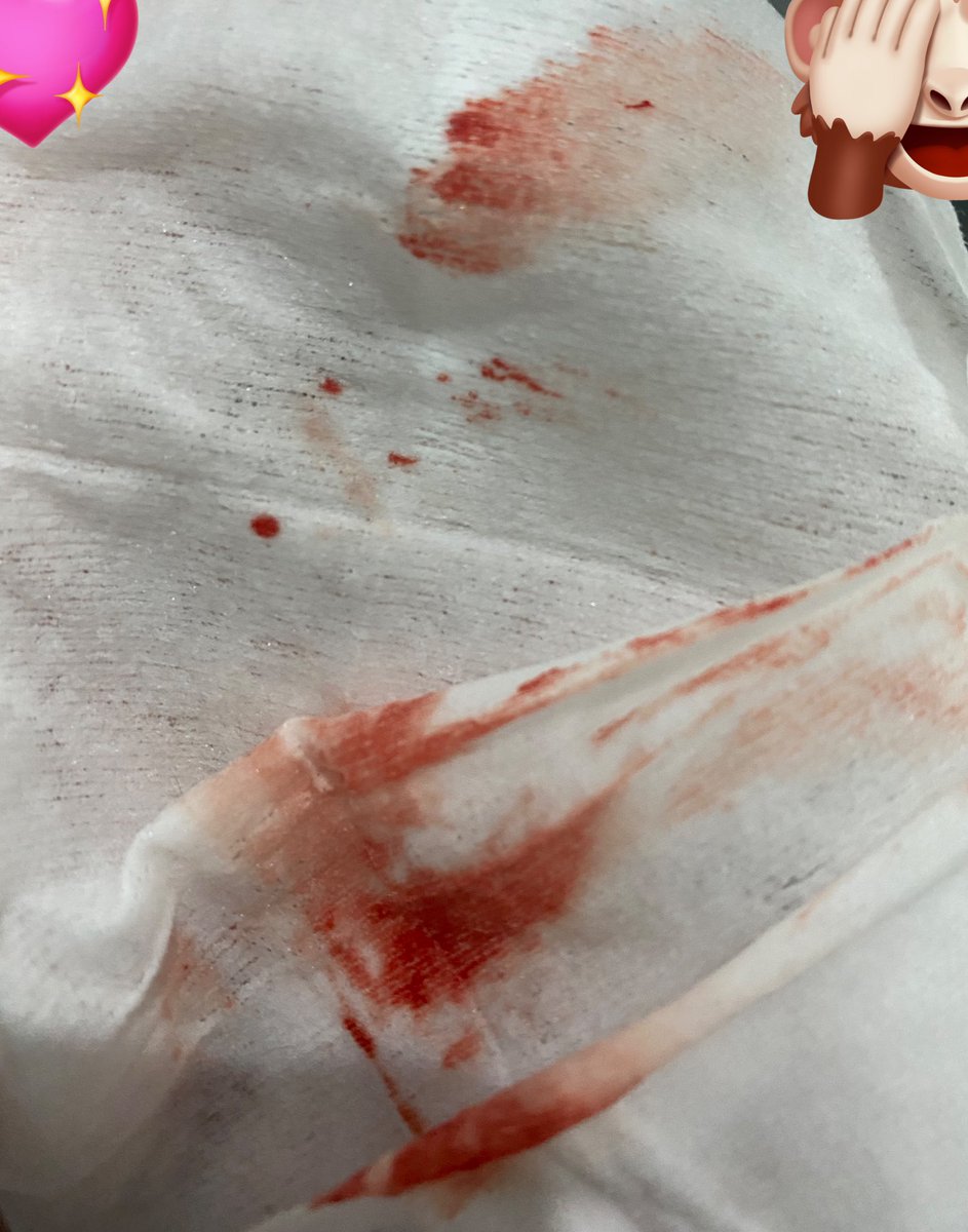 aa6loc's tweet photo. The razor being fresh-sharp-shiny....The blood slowly coming out makes my mouth watery... the fear and scaredness on his face..... The taste of my blood. The relief of the first cuts in 2025. 
I love this. But i might be a little bit retarded. https://t.co/SPFdzKqs7C