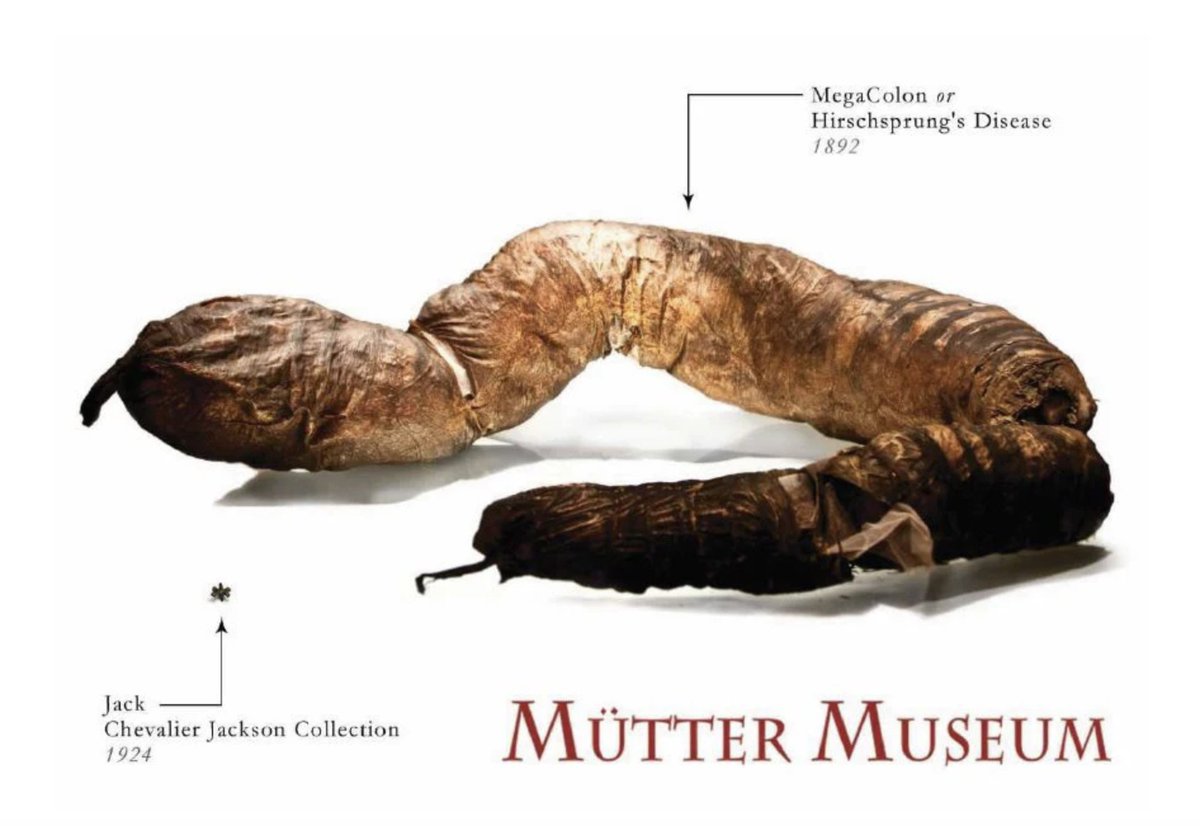 roddreher's tweet image. How tragic to have learned just now that Philadelphia's Mütter Museum gift shop no longer sells the Giant Colon plushy. Should have bought one when I live in Philly. This is probably USAID's fault. Least you can still buy a postcard of the old boy (8 ft long, 28 inches around).