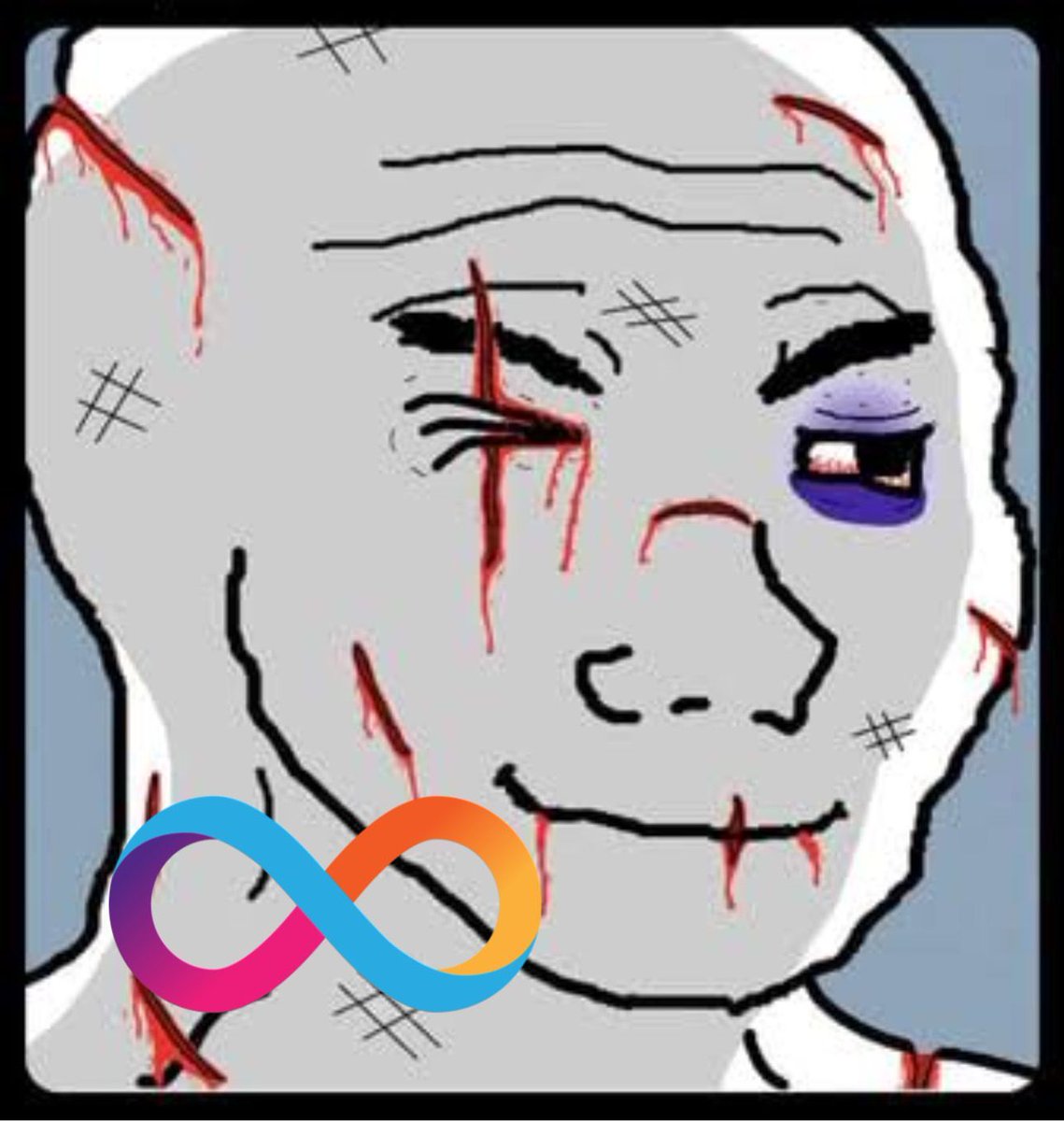 ICP holders know the pain… but also know what comes next 🔥