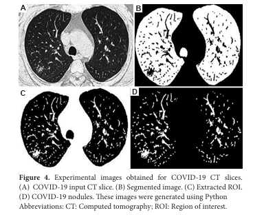 AIH_ASP's tweet image. 👀👀 Enjoy reading our publication #Diagnosis  of #Covid_19  from #computed #tomography slices using flower pollination #algorithm , k-nearest neighbor, and support vector machine #classifiers".
Authors: Khanna Nehemiah H. et al. @annauniversity  
doi.org/10.36922/aih.3…