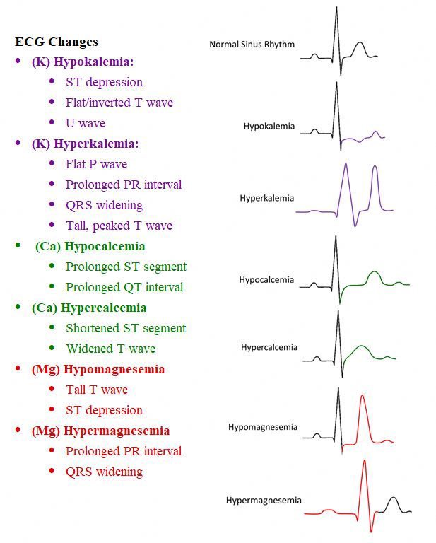 AppCardioNova's tweet photo. Cambios del #ECG en función de los #Electrolitos:
👉K #Potasio
👉Ca #Calcio
👉Mg #Magnesio

Un Buen Resumen Visual 👍 https://t.co/4uw9eykER5