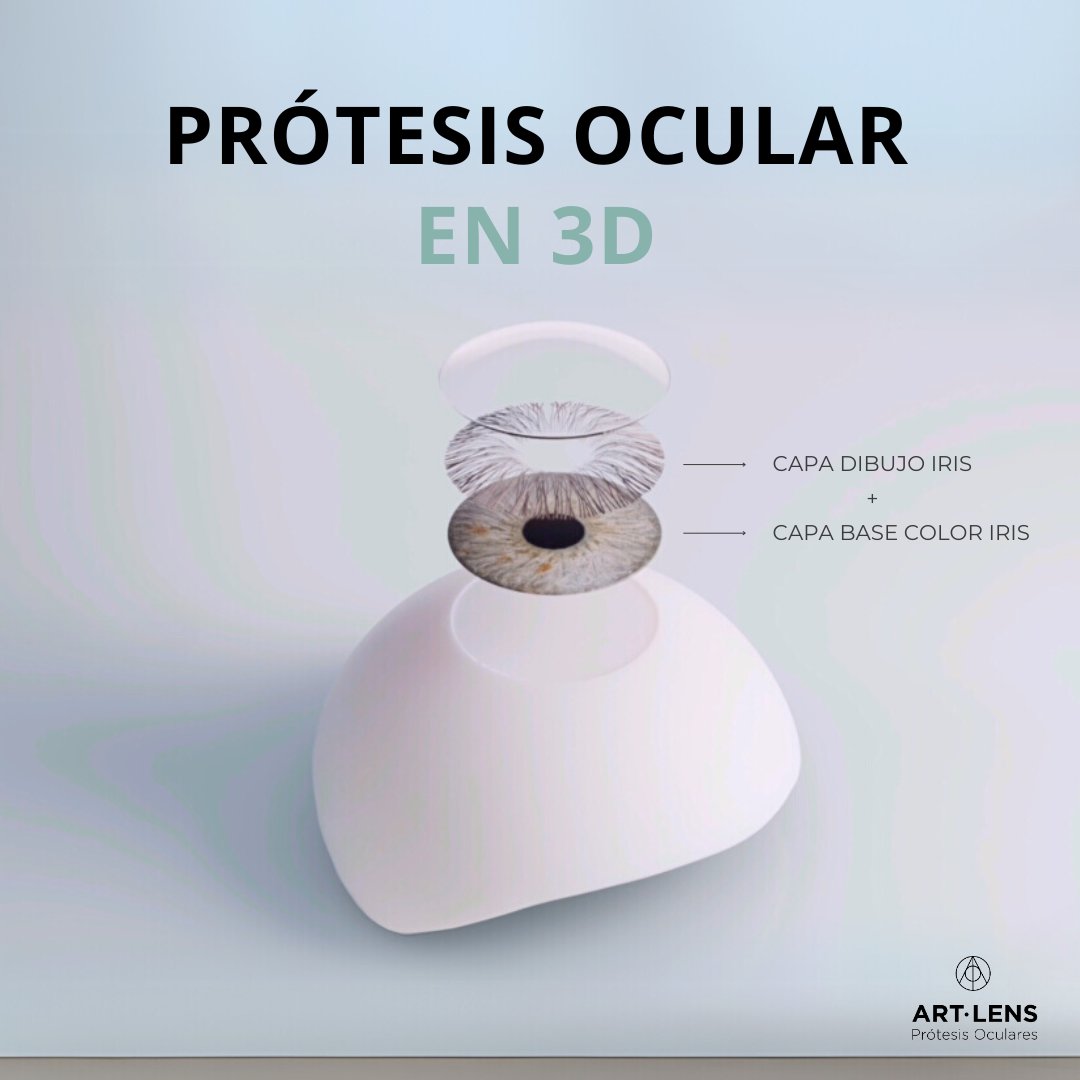 ArtLensBcn's tweet photo. La impresión 3D en color ha revolucionado las prótesis oculares, logrando un realismo sorprendente👁️✨
🔹 Mayor precisión en color y textura
🔹 Acabado antialérgico para más comodidad
🔹 Ajuste personalizado para cada paciente
Una mirada natural lo cambia todo.
#PrótesisOcular3D https://t.co/aWPORbqkpa