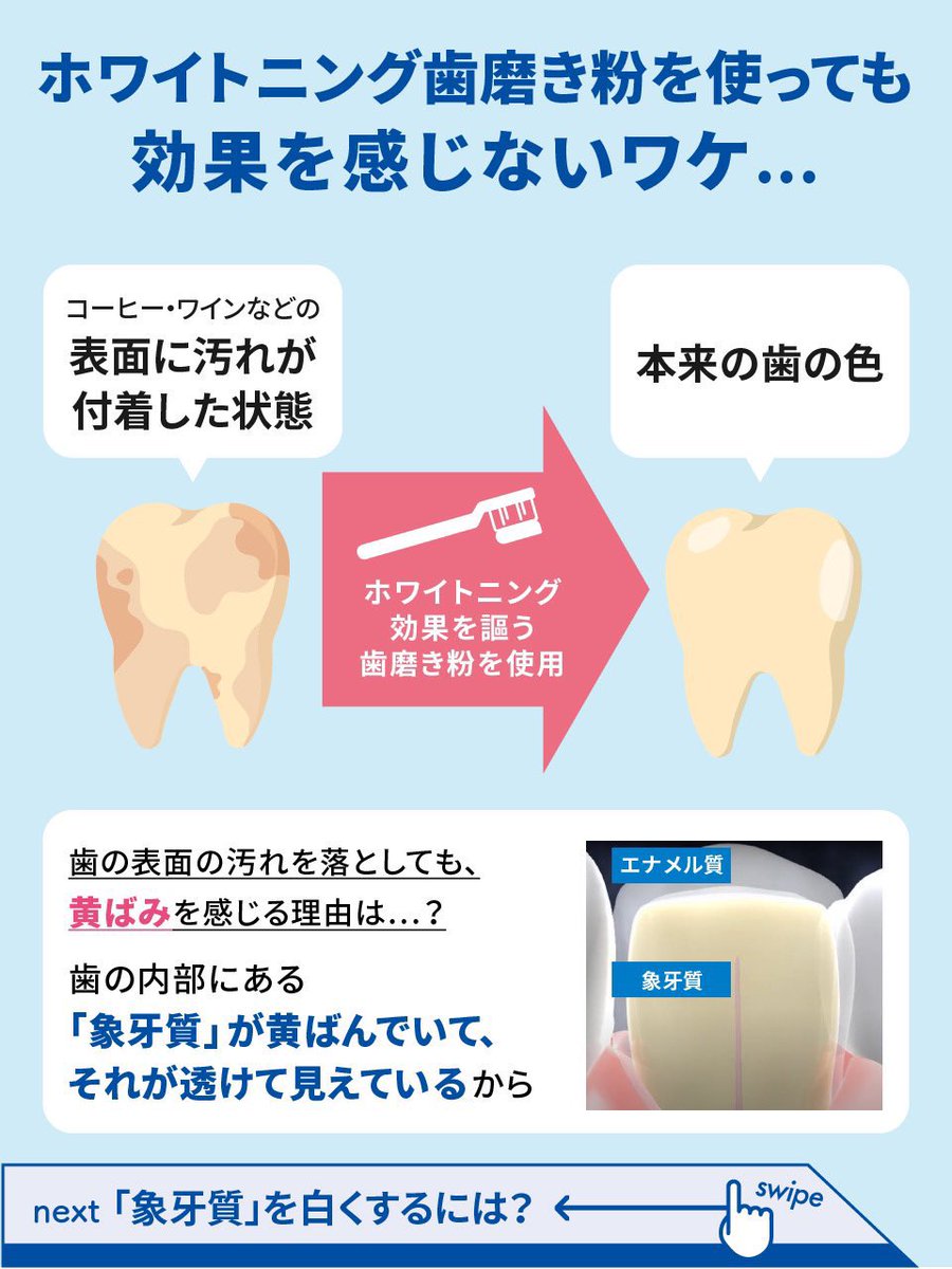 misaking823's tweet photo. 「歯磨き粉は重要」

適当に買ったそれとは成分がまるで違うから

審美歯科で選ばれるPEG400が配合された
歯の着色汚れが気になる方向けのシェールホワイトを頂きました✨

サンゴパウダー配合で歯を傷つけずに歯石を落としてツルツルにしてくれる✨

@whiteessence_we #pr https://t.co/8iBpoYvhKK
