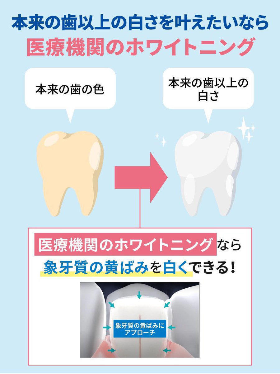 misaking823's tweet photo. 「歯磨き粉は重要」

適当に買ったそれとは成分がまるで違うから

審美歯科で選ばれるPEG400が配合された
歯の着色汚れが気になる方向けのシェールホワイトを頂きました✨

サンゴパウダー配合で歯を傷つけずに歯石を落としてツルツルにしてくれる✨

@whiteessence_we #pr https://t.co/8iBpoYvhKK