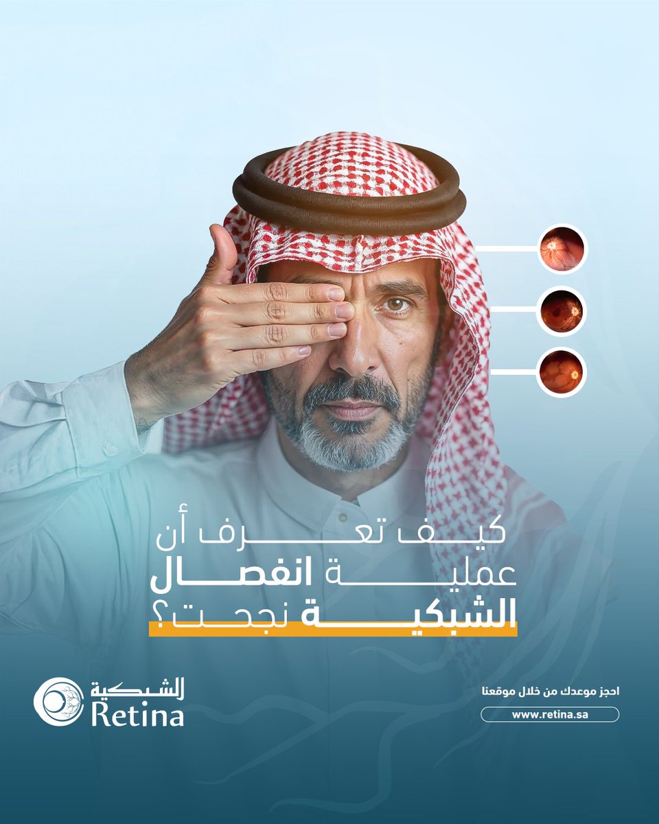 RetinaKSA's tweet photo. نجاح عملية انفصال الشبكية يعتمد على تحسين رؤيتك بمرور الوقت.

إذا حسيت إن الأمور صارت أوضح وإن البقع الداكنة أو الومضات اختفت، فهذي إشارات إيجابية جدًا.

لكن الأهم من كل هذا هو المتابعة المستمرة مع الطبيب للتأكد من ثبات الشبكية بعد العملية حتى لو شعرت بتحسن.

متابعة ما بعد العملية مهمة جدًا.. احجز موعدك الآن

▫️للحجز والاستفسار: 920004040 | 0531009666
▫️طريق الأمير سلطان بن عبدالعزيز، المعذر الشمالي، الرياض
.
.
#مجمع_الشبكية_الطبي #فحص_الشبكية #انفصال_الشبكية #حقن_الشبكية