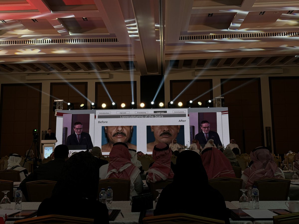 BeyariMaram's tweet photo. Honored to attend one of Saudi Arabia’s largest plastic and reconstructive surgery conferences, where I had the opportunity to meet and learn from leading doctors and experts in the field.

@PRRASMeeting https://t.co/G1gIbnNQHh