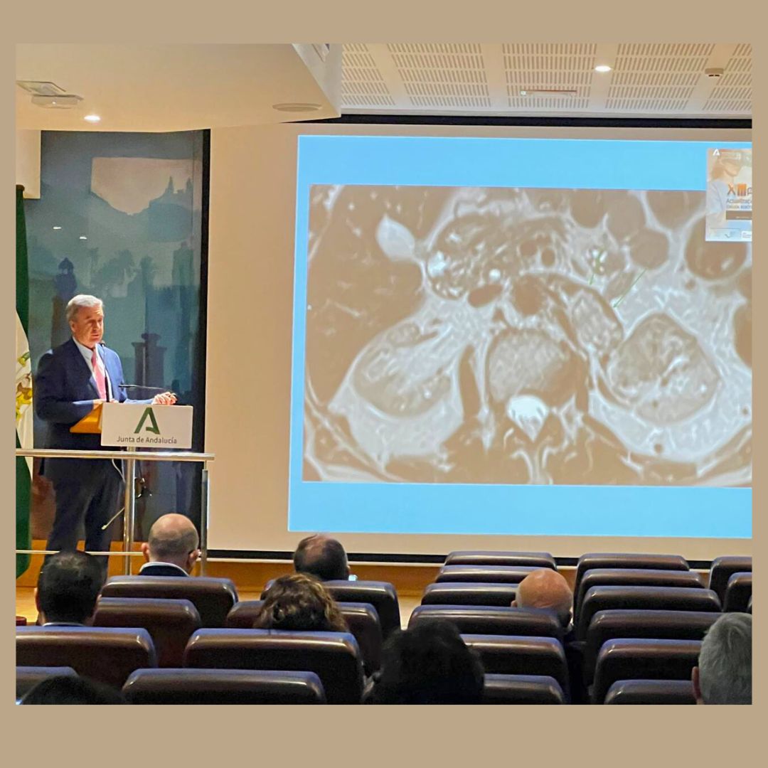 Clinica Premium Marbella (@clinica_premium) on Twitter photo Comprometidos con la innovación y la excelencia en #urología. 🔝Nuestro urólogo, el doctor <a href="/RamonBonilla/">RamonBonilla</a> participó el 13 y 14 de febrero 2025 como ponente en el XIII Fórum de Actualizaciones Urológicas en #Oncología y #CirugíaRobótica en el Hospital Puerta del Mar (Cádiz). Comprometidos con la innovación y la excelencia en #urología. 🔝Nuestro urólogo, el doctor <a href="/RamonBonilla/">RamonBonilla</a> participó el 13 y 14 de febrero 2025 como ponente en el XIII Fórum de Actualizaciones Urológicas en #Oncología y #CirugíaRobótica en el Hospital Puerta del Mar (Cádiz).