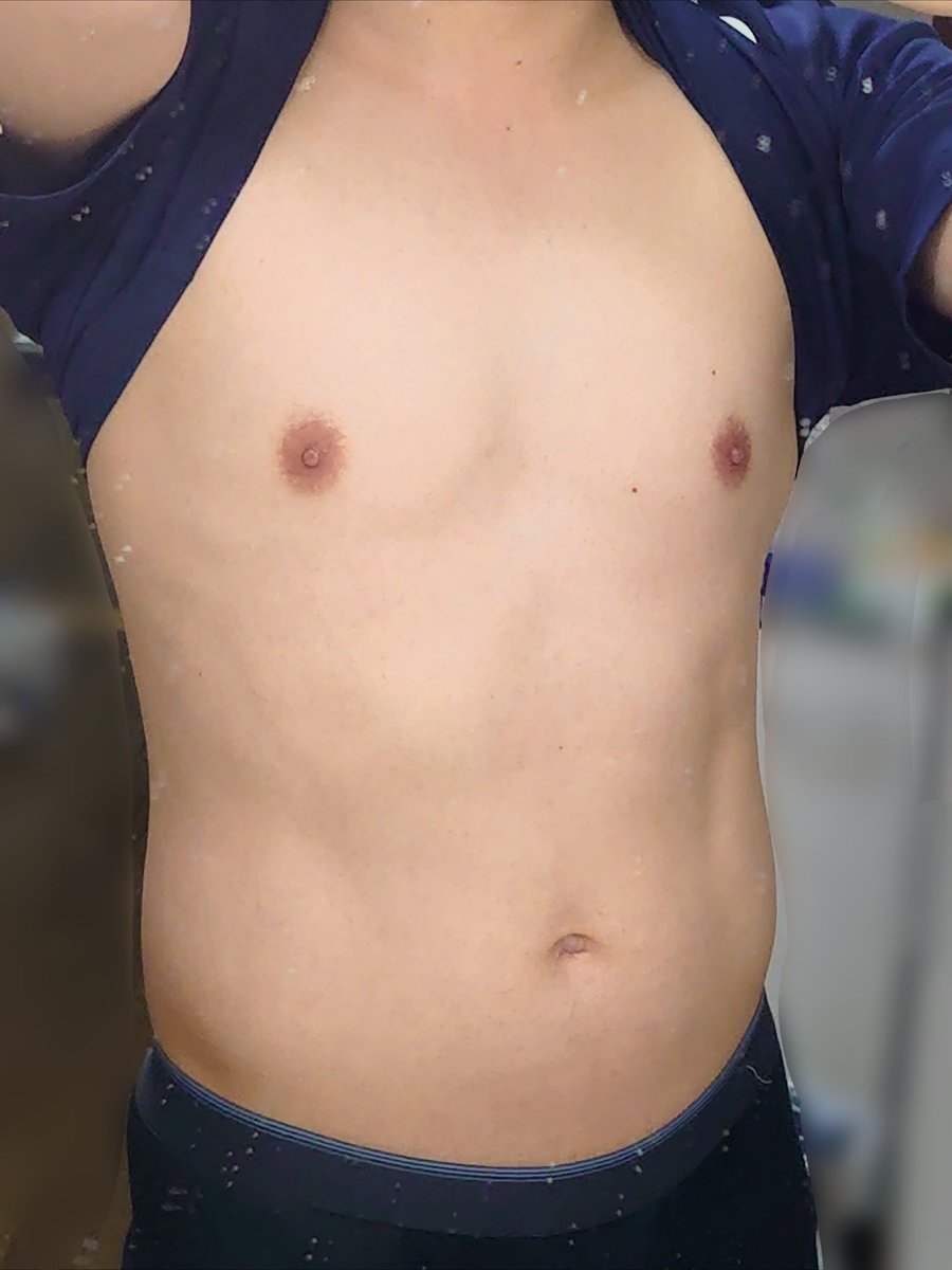 muu_bme's tweet image. 浮き輪肉って言うんかな
退化してる報告しかしてない