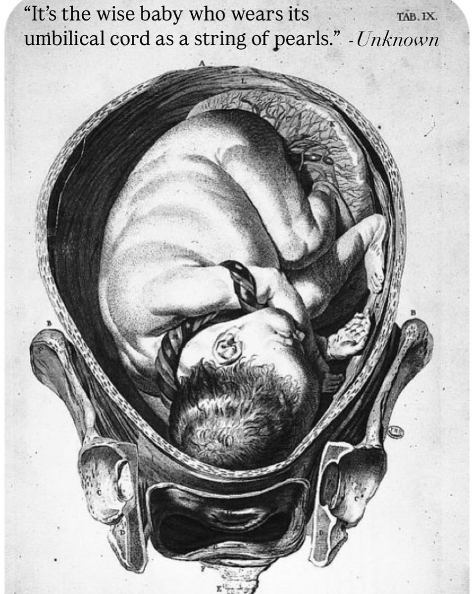 "What if the cord is around the baby's neck?" My quick response is, "You just slip it off or unravel it." The longer reply... The super active baby with a longer umbilical cord will often get tangled up in their cord and it's a non-issue. Babies do not breathe air through their