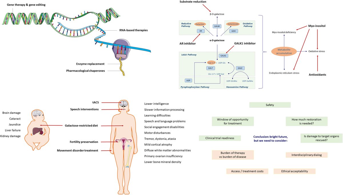 The Journal of Inherited Metabolic Disease (@jimd_editors) on Twitter photo The Leloir pathway was described over 7 decades ago, there are significant shortcomings in the current approach to Galactosemia management.
This new article explores possible future therapies:
👉 doi.org/10.1002/jimd.7…
<a href="/GalactosemiaFDN/">GalactosemiaFDN</a> #galactosemia The Leloir pathway was described over 7 decades ago, there are significant shortcomings in the current approach to Galactosemia management.
This new article explores possible future therapies:
👉 doi.org/10.1002/jimd.7…
<a href="/GalactosemiaFDN/">GalactosemiaFDN</a> #galactosemia