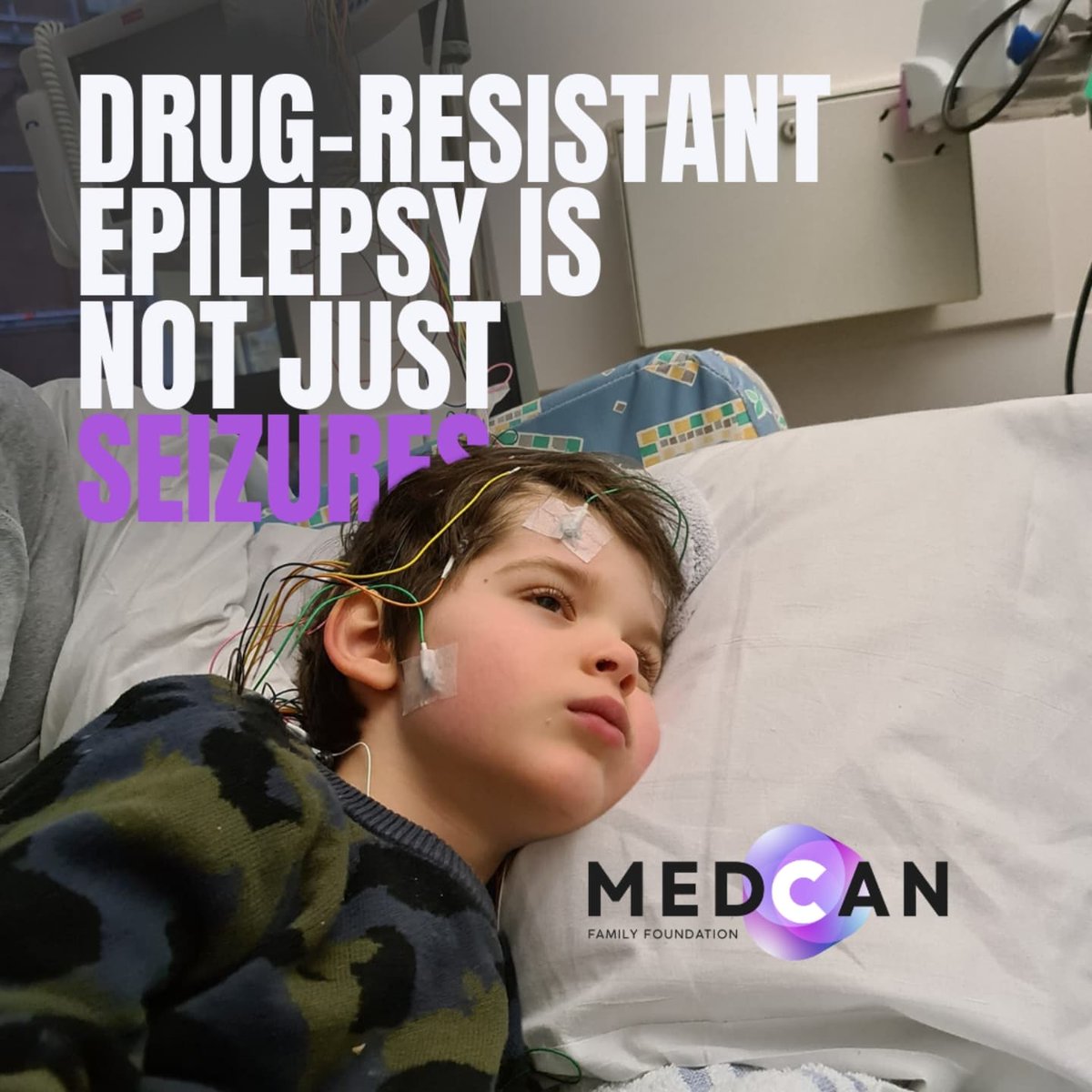 It's developmental delay, learning difficulties, disability, behavioural challenges, unpredictability, anxiety, panic attacks, insomnia, exhaustion, irritability, anger, frustration. 
It's finding that balance between seizure control and quality of life.
#internationalepilepsyday