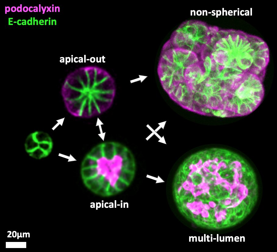 Just out: "Programmable viscoelastic #hydrogels uncover #mechanosensing timescales and direct cell polarity"

biorxiv.org/content/10.110…

We used a #DNA-based nanomaterial—#DyNAtrix—to study and guide the polarization of epithelial cells.

🧬 #nanotechnology #materials #cell_culture