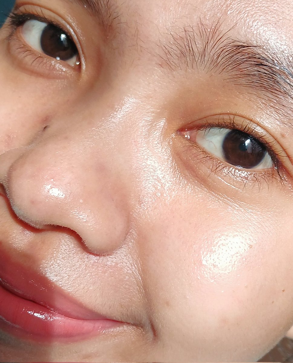 s0ftgurll's tweet image. Aku lagi pake 3 produk ini sebulan kurang rutin pagi dan malam pengen tau hasilnya bagus atau engga 

Ternyata bagusss gaes beneran ini jerawat aku jadi ga aktif lagi dan bekasnya lumayan memudar luvvv banget