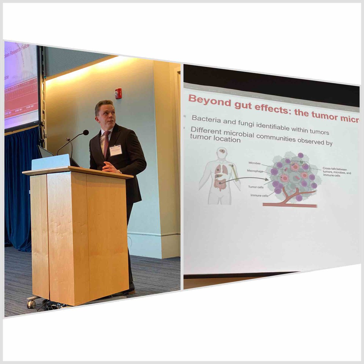 Adam Burgener (@adam_d_burgener) on Twitter photo Dennis Grencewicz from <a href="/OhioState/">Ohio State</a> presenting data on how Candida Albicans may affect treatment response of tumors at the 3rd Annual Case Comprehensive Cancer Center Microbiome Workshop
<a href="/caseccc/">Case Comp Cancer Ctr</a> <a href="/cwru/">Case Western Reserve</a> #microbiome Dennis Grencewicz from <a href="/OhioState/">Ohio State</a> presenting data on how Candida Albicans may affect treatment response of tumors at the 3rd Annual Case Comprehensive Cancer Center Microbiome Workshop
<a href="/caseccc/">Case Comp Cancer Ctr</a> <a href="/cwru/">Case Western Reserve</a> #microbiome