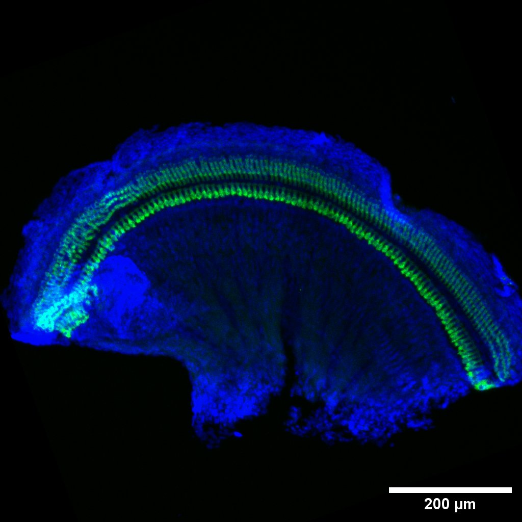 HearingShef's tweet image. Happy #MicroscopyMonday!📸Here we have one of Charlie’s first immunos from the start of his PhD! This image captures the apical turn of the organ of Corti. Nucleis are labelled with DAPI(blue) and hair cells with myosin-7a(green), a vital protein for both hearing and vision!👀👂
