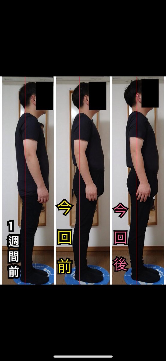KAORItheChiro's tweet photo. 変化に震える:(´◦ω◦｀): https://t.co/RxIiOnL6Fl