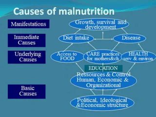 The major causes of nutritional deficiencies are insufficient intake of food, inability to absorb #nutrients , and consumption of diets that lack some of the essential nutrients. #JNDT