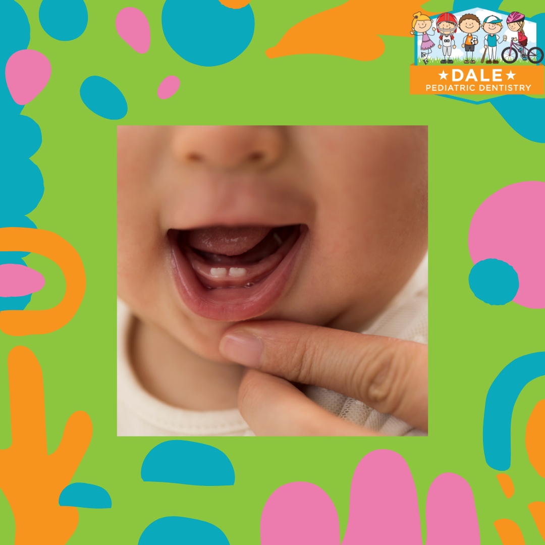 DalePDentistry's tweet photo. Your child’s dental journey starts with their first tooth and continues well into adulthood! Baby teeth are important placeholders for permanent teeth and play a key role in speech development. Let’s work together to keep their smile strong every step of the way! 

#dalepediat... https://t.co/wWokbttzaT