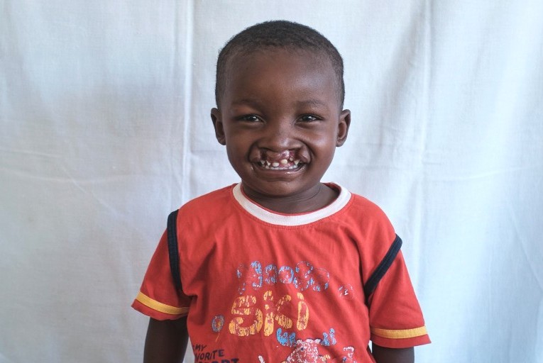 SmileTrainAfric's tweet photo. What could be more positive than starting your week with a Smile Train patient's beaming smile?
Every child with a cleft deserves to smile. Please help us find them. Africa@smiletrain.org
#SmileoftheWeek #cleftwarriors https://t.co/0chlBDG4MM