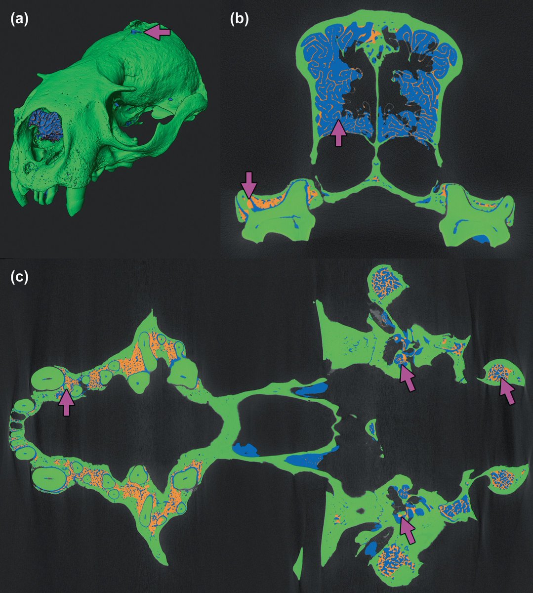 Innovative new technique for segmentation of cortical bone, trabecular bone, and medullary pores from micro-CT images using 2D and 3D deep learning models. 
Andrew Lee et al.: buff.ly/3EAbFT2