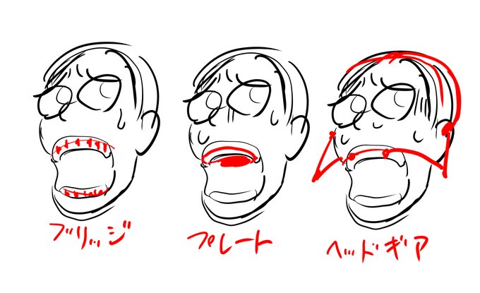 酒)小2の頃から10年間弱歯科矯正やってたんだけどさ。んで現在まーまーな歯列だと思うんだけど。あれからうん十年経った今でも歯科矯正してる夢を見る。プレートのヤツがやけに生々しくてねぇ。矯正に抜歯は付き物だけど(何本抜かれたやらw)当時のキシロカイン注射痛くてね～><今は基本無痛でいいっス 