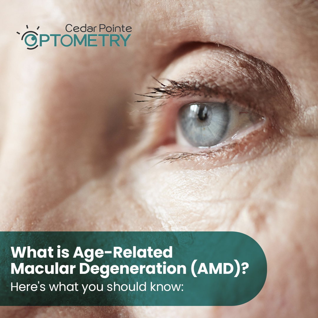 CedarPointeODs's tweet image. AMD affects central vision, making it harder to read or recognize faces. It often develops with no early symptoms, but lifestyle changes can help slow it down. Regular eye exams are key. If you're 55+, book your check-up today!

#AMDawareness #HealthyVision #CedarPointeOptometry