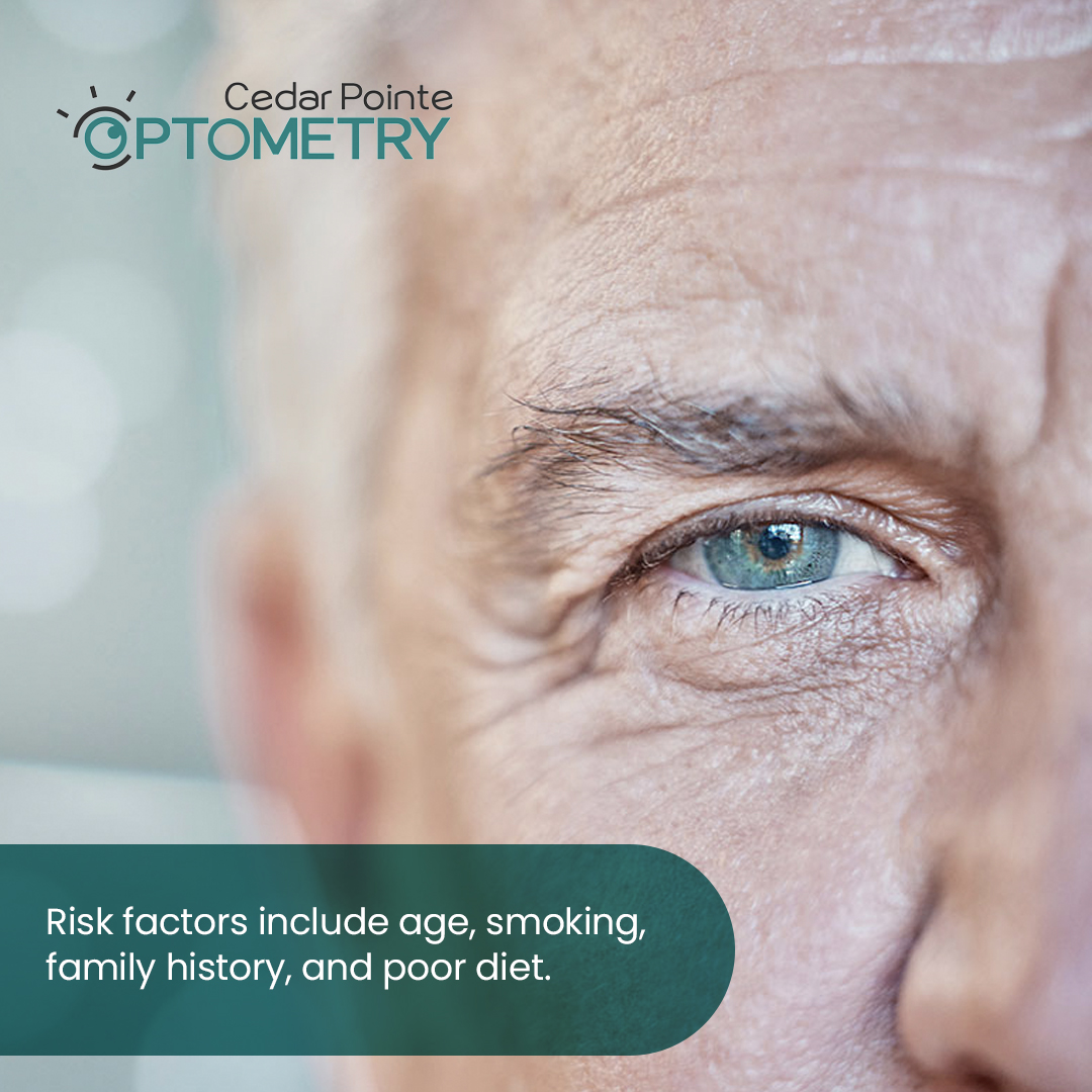 CedarPointeODs's tweet image. AMD affects central vision, making it harder to read or recognize faces. It often develops with no early symptoms, but lifestyle changes can help slow it down. Regular eye exams are key. If you're 55+, book your check-up today!

#AMDawareness #HealthyVision #CedarPointeOptometry